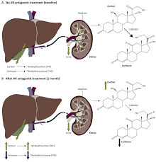 Deep Androgen Receptor Suppression In Prostate Cancer Exploits Sexually Dimorphic Renal Expression For Systemic Glucocorticoid Exposure Annals Of Oncology