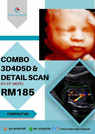 Assalamulaikum, Hi, Klinik safamedic Setapak Ada Buat scan untuk ibu yang  mengandung, Di bawah sini ada antara pakej2 dan mingguan yang sesuai untuk  ibu yang nak scan. Untuk scan 5D, Detail scan