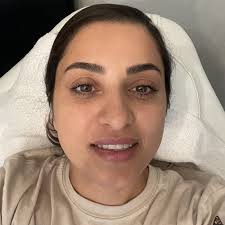 BEST of Gilroy, CA Estheticians