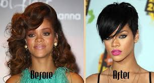 Rihanna Skin Bleaching Before And After Beyonce Skin Lightening Beyonce Skin Skin Bleaching Lighten Skin