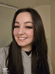 My Experience Taking Off My Own Braces