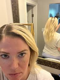 Meadow Skyy Aesthetics and Wellness Lip filler special this month. 1/2  syringe $350 and full $550. This month only $100 off full and $50 off half.  DM, text or call 936-333-7303