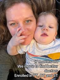 Delayed Motor Skills at 9 Months