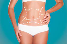 What is Meant By Tummy Tuck, and How Does it Work?