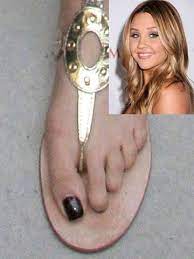 Amanda Bynes Toe Nails Are On The Tips Wtf Toe Pics Corn On Toe Celebrity Feet