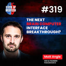 Mark Lehmkuhle, CEO & Founder of Epitel: $20 Million Raised to Build the  Future of Brain Health Monitoring