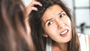 Check out these dandruff myths as well as dandruff has been my big secret since i was a young girl. Dandruff What Your Itchy Scalp Is Trying To Tell You