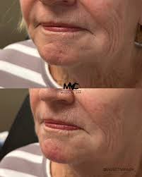 Midwest Vein Care & Medical Spa