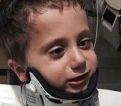 Four-year-old Boy Survives Internal Decapitation After Accident