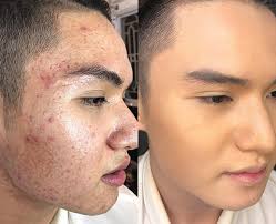 Kết quả hình ảnh cho gương mặt đẹp khi xài serum