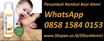 Orang tua mana yang saat ini tidak ingin jika bayinya memiliki rambut yang tumbuh subur, sehan dan lebat. Cara Untuk Melebatkan Rambut Bayi