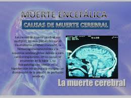 Esto puede ser causado por una lesión grave en la. Mari