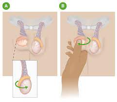 The hcp will likely test some of your reflexes (i.e. Testicular Torsion Concise Medical Knowledge