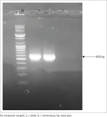 Image result for Isoberlinia doka