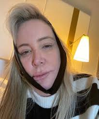 Shannon Beador Had Emergency Dental Surgery amid 'Severe' Tooth Pain