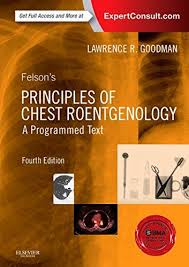 1455774839 Felson S Principles Of Chest Roentgenology A Programmed Text 4e Ebook Textbook Principles