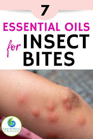 Bug Bites That Look Like Mosquito Bites But Hurt Top 7 Essential Oils For Bug Bites Essential Oil Perfume Essential Oils Chamomile Essential Oil