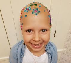 Check spelling or type a new query. A 7 Year Old Girl With Alopecia Wins Crazy Hair Day Competition