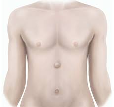The chest cavity ends a short distance under this may sometimes extend deeper under the left ribcage. Epigastric Hernia Repair Adult Healthdirect