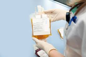 Image result for Plasma Transfusion