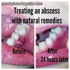 Pin On Dental Health