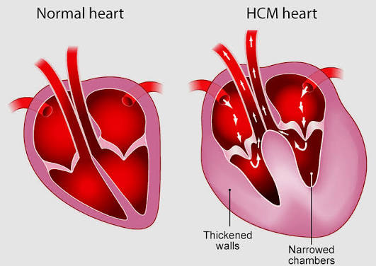 HCM (Hypertrophic Cardiomyopathy) in Cats - PDSA