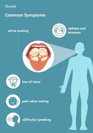 Image result for oral thrush symptoms roof of the mouth