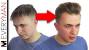 Before And After Thin To Thick Hair