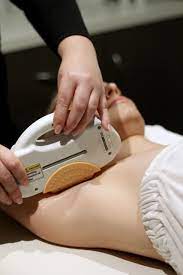 Unlike standard beauty salons, our staff include medical experts. Hair Removal Shr Ipl Body Wisdom Perth