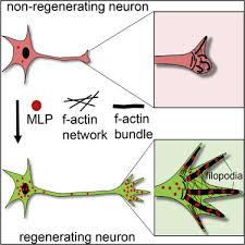 In clinical trials in parkinson's disease, a volume of the neuromethods series by springer nature. Muscle Lim Protein Is Expressed In The Injured Adult Cns And Promotes Axon Regeneration Sciencedirect