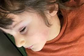 Four-year-old died from sepsis after doctors didn't recognise  neurodivergent child's "atypical" presentation