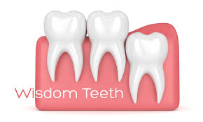 Wisdom teeth removal is usually covered under medical insurance if they are impacted and need to be removed by an oral surgeon. Wisdom Teeth Removal Cost 2021 Omega Dental Houston Tx