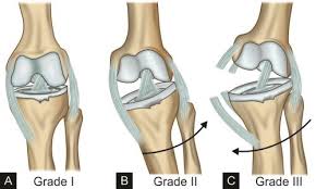 It may cause redness and pain. Jaypeedigital Ebook Reader