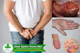Readmore → obat yang ampuh untuk gonore. Obat Sipilis Untuk Pria Tanpa Efek Samping Sandi Ibrahim