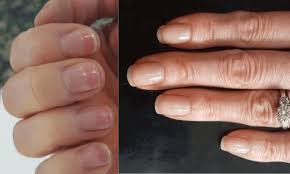 If your nails feel weak after you take off the acrylics, it's likely they will break, which can be painful and result in jagged edges.1 x research source cut your. Repair Nails After Acrylics Like Cass French Manicure Acrylic Nails Nails After Acrylics Pretty Acrylic Nails
