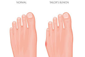 Pin On Health