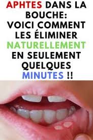 Pin On Sante Bien Etre