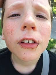 The Camp Bullies: I think we lost that talking museum