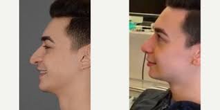 Charles East, MBBS, FRCS, Facial Plastic Surgeon