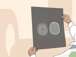 Anxiety too doesn't rely on stress to appear, it's more complex than that. 3 Simple Ways To Get A Brain Scan Wikihow