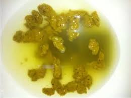 We did not find results for: Pancreatic Cancer Poop Pancreatic Cancer Yellow Stool