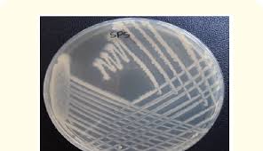 Maybe you would like to learn more about one of these? Cream Coloured Colonies Of Clostridium Perfringens On Sulphite Download Scientific Diagram