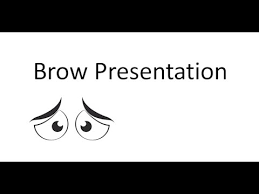 Image result for Brow Presentation