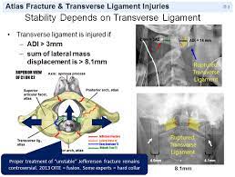 Isolated cervical transverse process fracture (tpf) of the subaxial cervical spine can be considered as clinically insignificant and do not require treatment 3). Atlas Fractures Transverse Ligament Injuries Spine Orthobullets