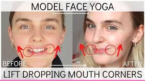 Getting Rid of Dropping Mouth Corners