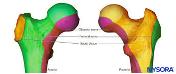 Image result for Intrapleural Anesthesia