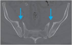 Musculoskeletal Section 9 Emergency Radiology Coffee Case Book