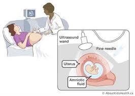 Prenatal Testing