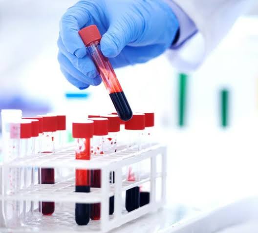 Blood Test product image