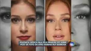 A atriz, que tem como sua marca registrada os cabelos ruivos, resolveu radicalizar e surgiu com os. Medica Explica Postagem Sobre Aparencia Da Atriz Marina Ruy Barbosa Youtube